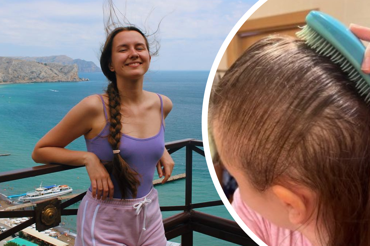 «Не буду носить парики»: реальная история Яны из Хабаровска — после ковида она потеряла волосы за две недели