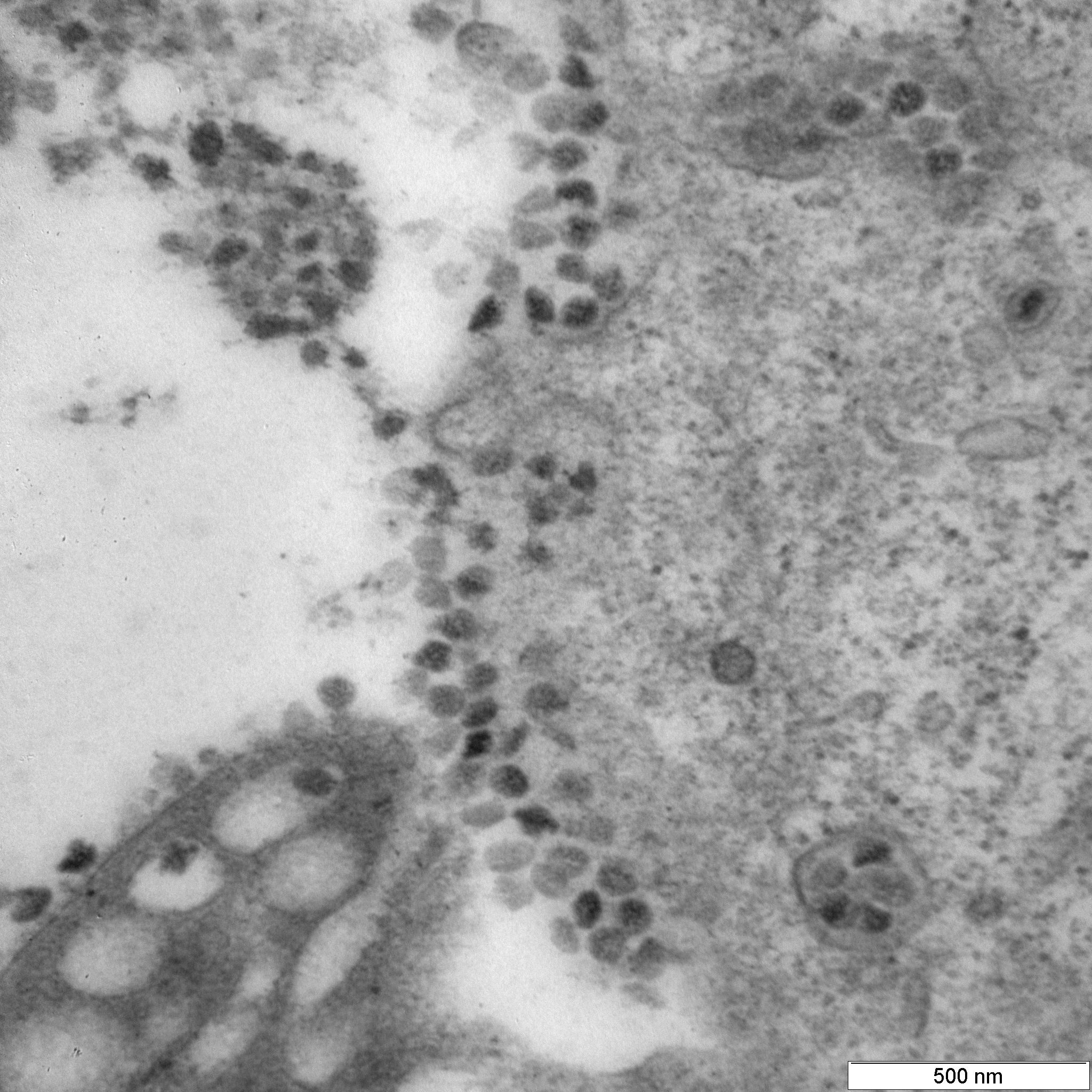 Вирусные частицы коронавируса (штамм «омикрон»), вышедшие из клетки и скопившиеся на ее поверхности (клетки Vero Е6, 6-е сутки после инфицирования).