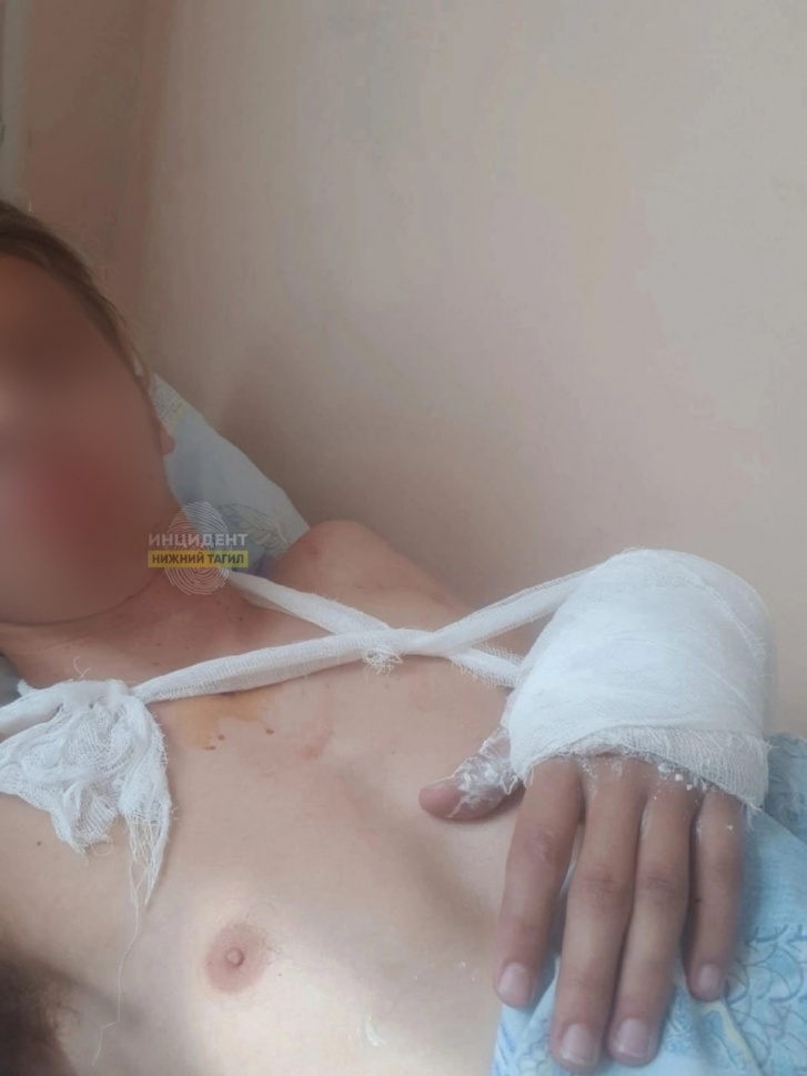 Подросток Сергей чудом выжил в аварии