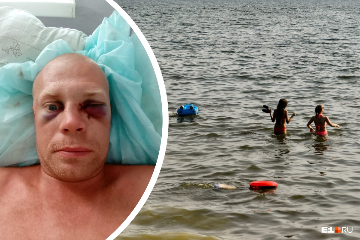 «Я не могу дышать». На Урале прапорщик ГУФСИН сломал челюсть парню, который переодевался на пляже