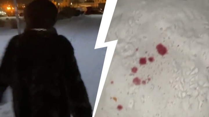 Екатеринбурженка сняла на видео женщину, которая разбрызгивала розовую отраву для собак на сугробы