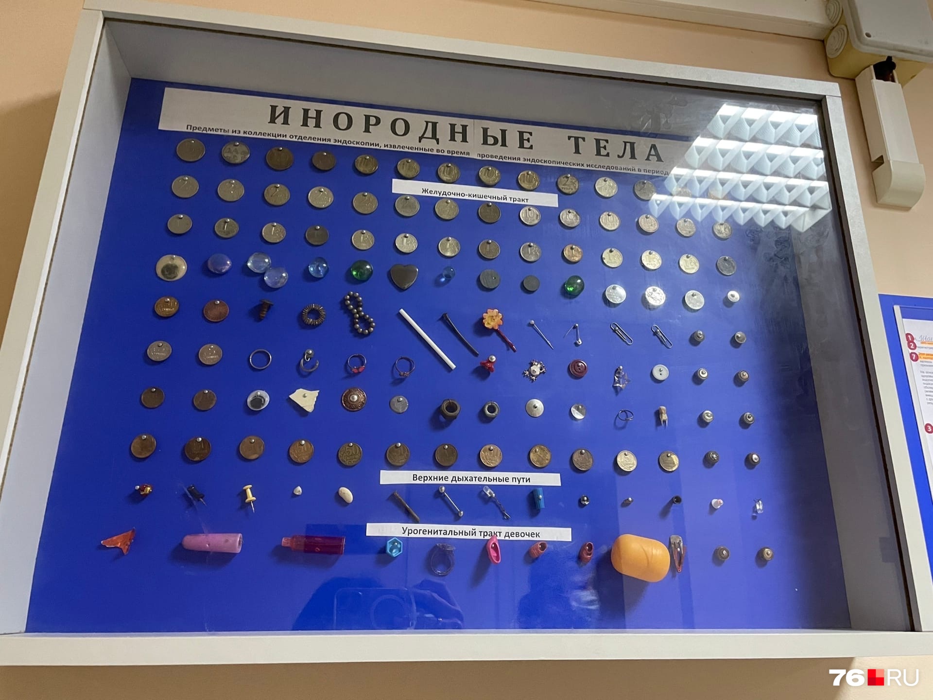 В коридоре эндоскопического отделения целый музей инородных тел В коридоре эндоскопического отделения целый музей инородных тел
