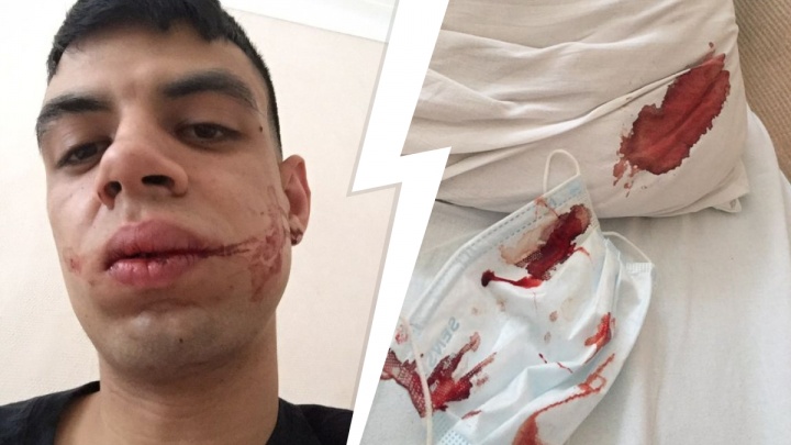 «Угрожали, что убьют». В Екатеринбурге студент из Марокко загремел в больницу после драки в скандальном баре
