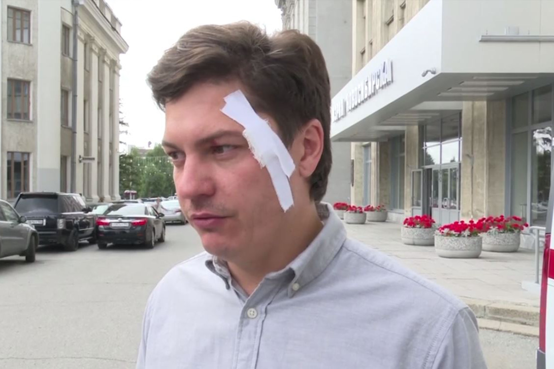 «Достаточно жесткое было задержание»: вице-мэр Артем Скатов собрался ехать в травмпункт после обысков