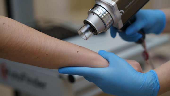 В сети медцентров «Доктор АРБИТАЙЛО» появился уникальный аппарат для диагностики образований кожи