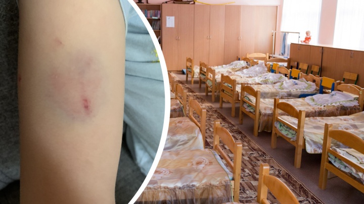 «Кусал и бил»: в Ярославле родители детсадовцев пожаловались на агрессивного ребенка в группе