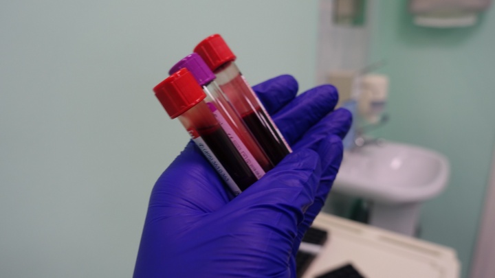 Общий анализ крови: зачем его делать и как разобраться в результатах