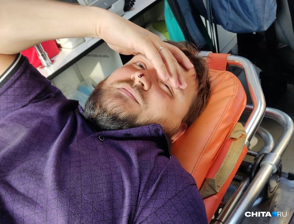 Бутылка упала с высоты на голову журналиста в Чите