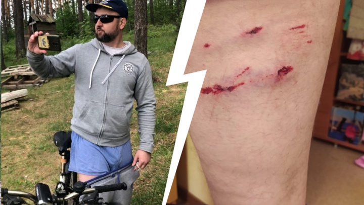 «Лес — общественная территория». На базе отдыха под Екатеринбургом собака напала на велосипедиста