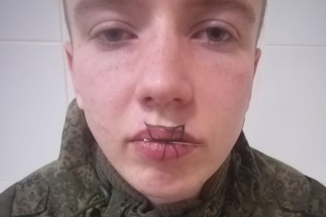 Солдата с зашитым ртом увезли в больницу Солдата с зашитым ртом увезли в больницу