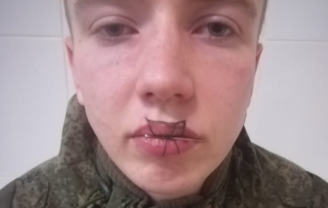 Студент Тюменского духовного училища зашил себе рот, находясь в армии. Что говорят мама и девушка