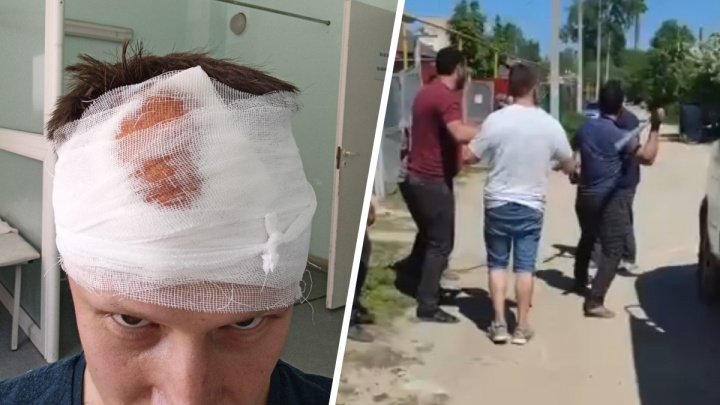 В Березовском цыгане избили мужчину металлической битой. Массовая драка попала на видео
