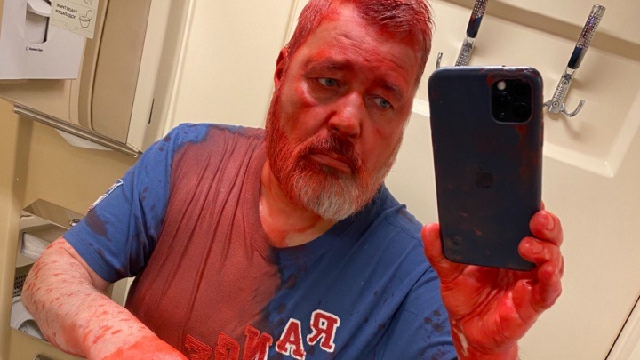На самарского журналиста напали в поезде и облили краской