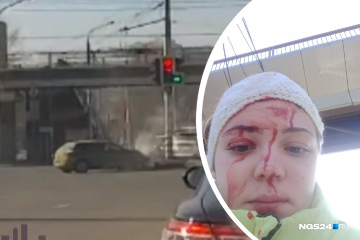 В больнице Софье наложили несколько швов, а первую помощь на месте оказал сотрудник ГИБДД В больнице Софье наложили несколько швов, а первую помощь на месте оказал сотрудник ГИБДД