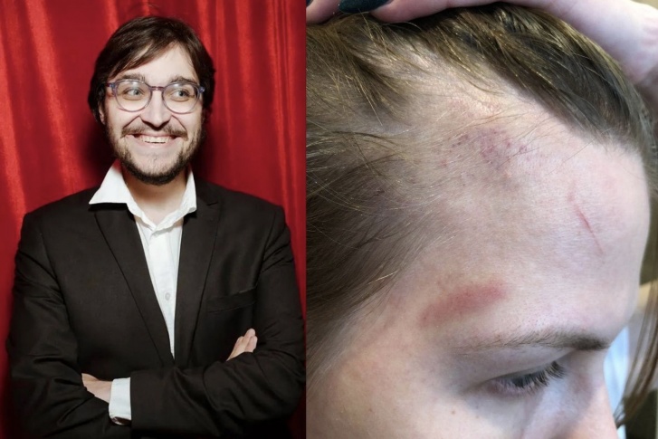 Журналистка Ольга Житпелева опубликовала в соцсетях фотографии ссадин и ушибов на лице