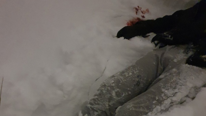 В Северодвинске нашли на улице мужчину с ножевым ранением