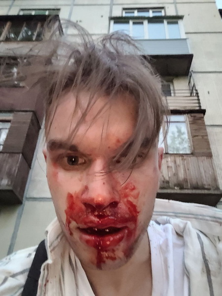 В Петербурге у дома неизвестные избили журналиста издания Sota.vision