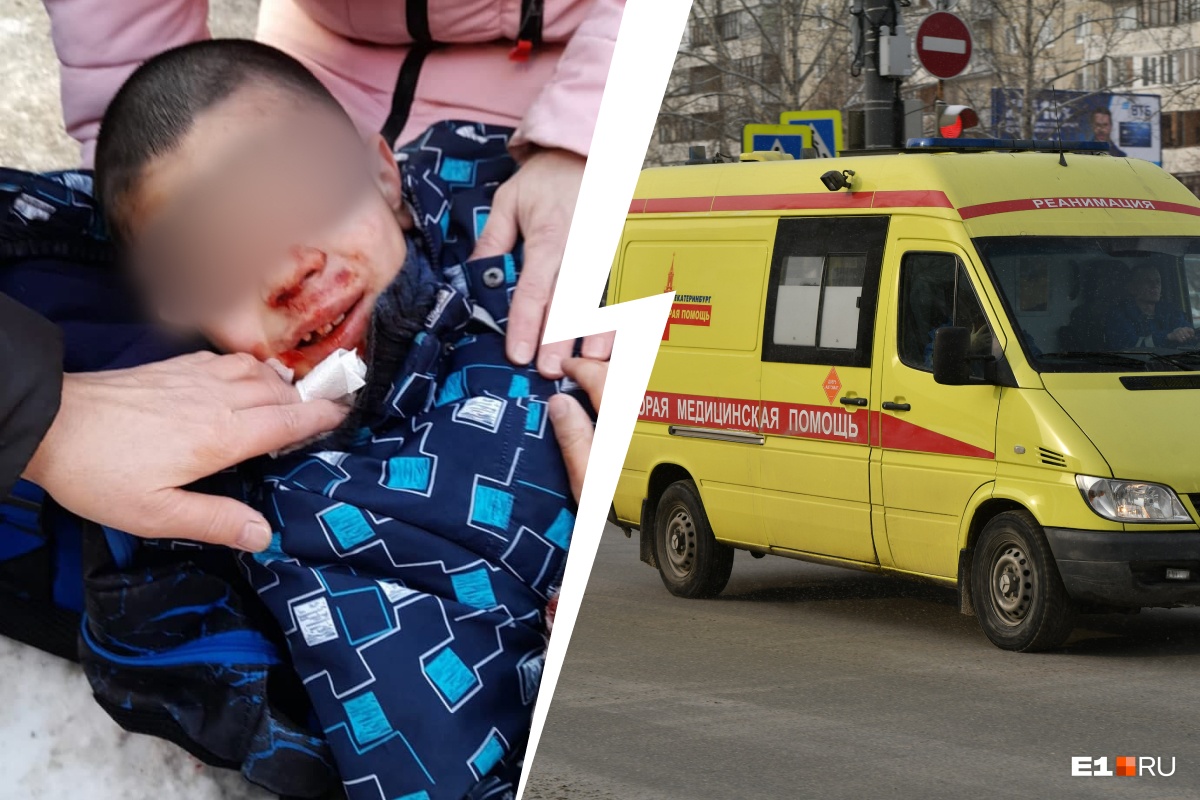 «Лицо в крови»: на Химмаше ребенка сбила машина
