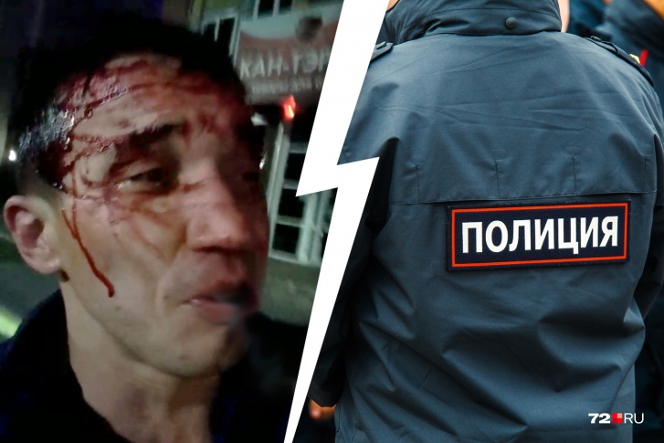 После инцидента мужчина оказался с окровавленной головой После инцидента мужчина оказался с окровавленной головой