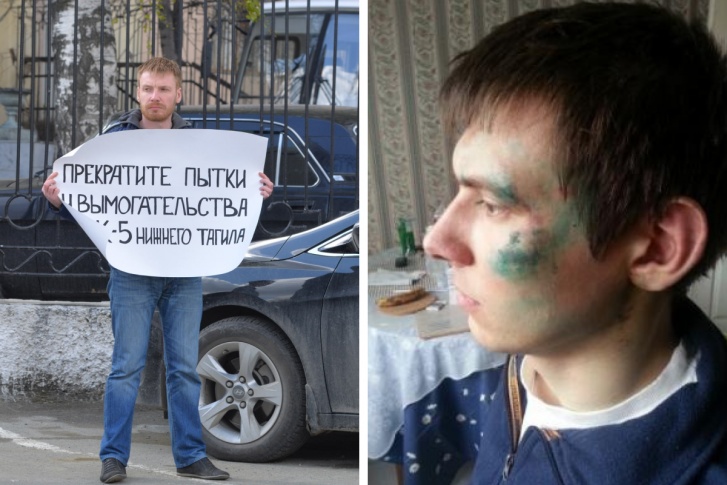 Фото повреждений Павла Баронина после задержания Фото повреждений Павла Баронина после задержания