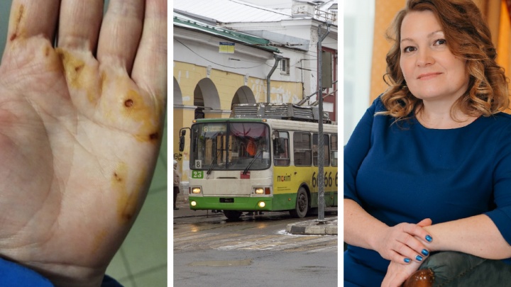 «Руки прилипли к поручням»: в ярославском троллейбусе пассажирка потеряла сознание от удара током