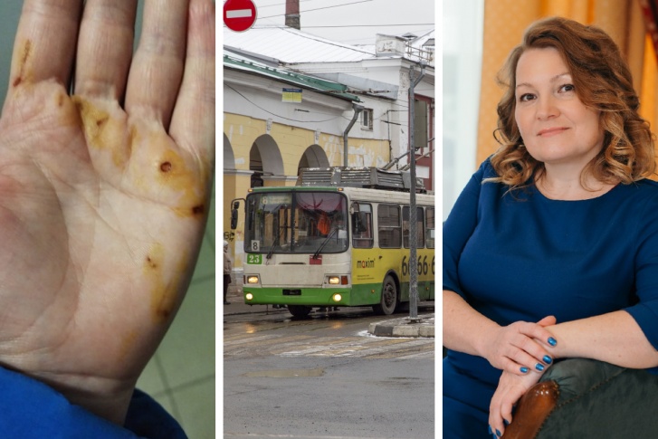 Елену сильно ударило током, когда она взялась руками за поручни в ярославском троллейбусе