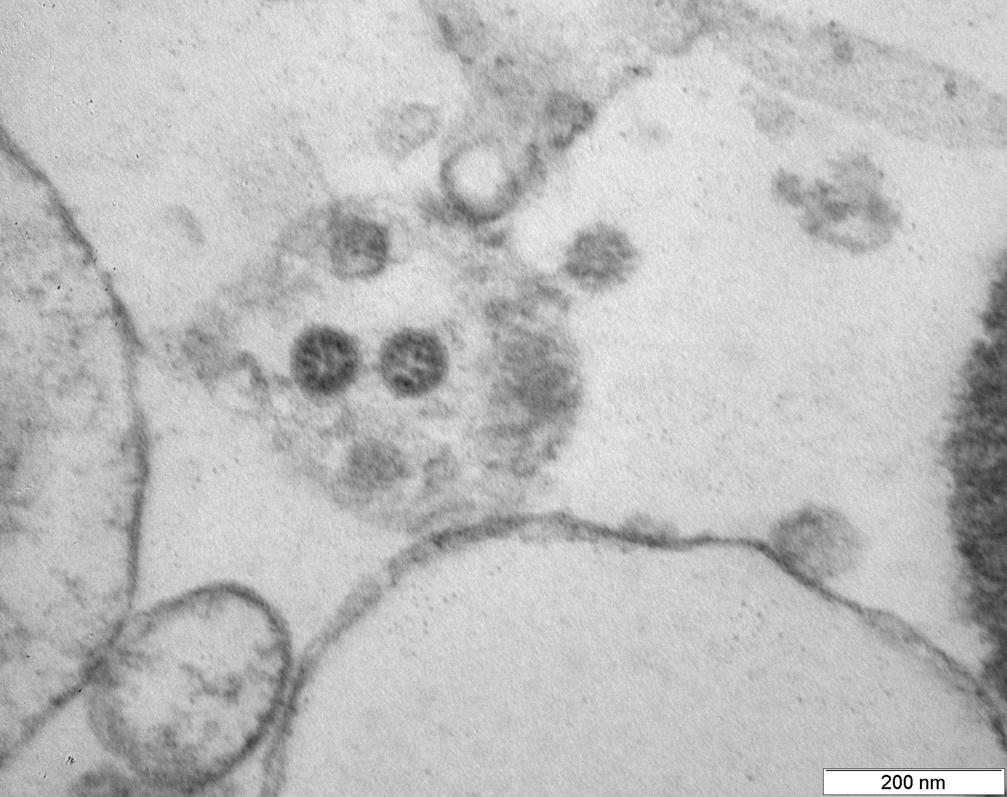 Вирусные частицы коронавируса (штамм «омикрон») типичной формы, но имеющие малое количество поверхностных структур (клетка Vero Е6 на 6-е сутки после инфицирования).