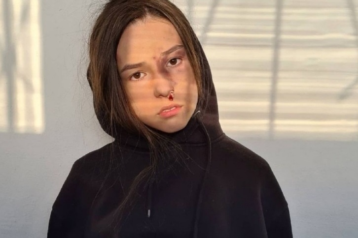 Полину с детства избивал отец, в 12 лет она ушла из семьи. На этом фото она в гриме (Поля ведет блог о домашнем насилии), а в детстве она так выглядела после побоев Полину с детства избивал отец, в 12 лет она ушла из семьи. На этом фото она в гриме (Поля ведет блог о домашнем насилии), а в детстве она так выглядела после побоев