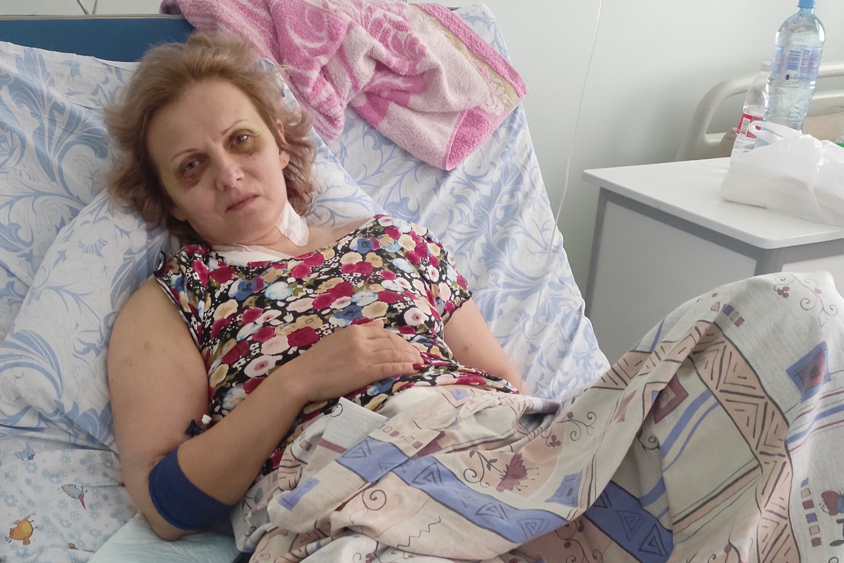 Елена после операции в Краснодарской краевой клинической больнице Елена после операции в Краснодарской краевой клинической больнице