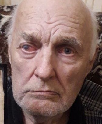 Полиция разыскивает 85-летнего мужчину, пропавшего два дня назад в поселке Маркова