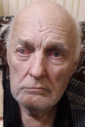 Полиция разыскивает <nobr class="_">85-летнего</nobr> мужчину, пропавшего два дня назад в поселке Маркова
