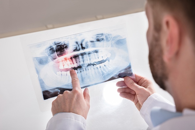 Имплантация — это метод восстановления отсутствующего зуба или нескольких зубов