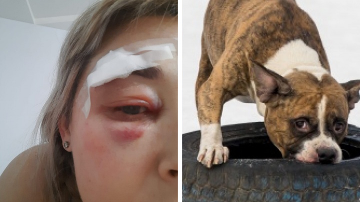 «Всё лицо в крови было». В Екатеринбурге хозяин собаки избил женщину за замечание и скрылся от полиции
