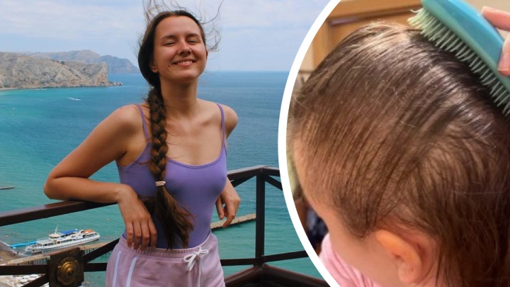 «Не буду носить парики»: реальная история Яны из Хабаровска — после ковида она потеряла волосы за две недели