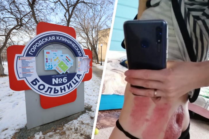В ГКБ № 6 пациентке сделали операцию — избавили от внематочной беременности, но сожгли кожу В ГКБ № 6 пациентке сделали операцию — избавили от внематочной беременности, но сожгли кожу