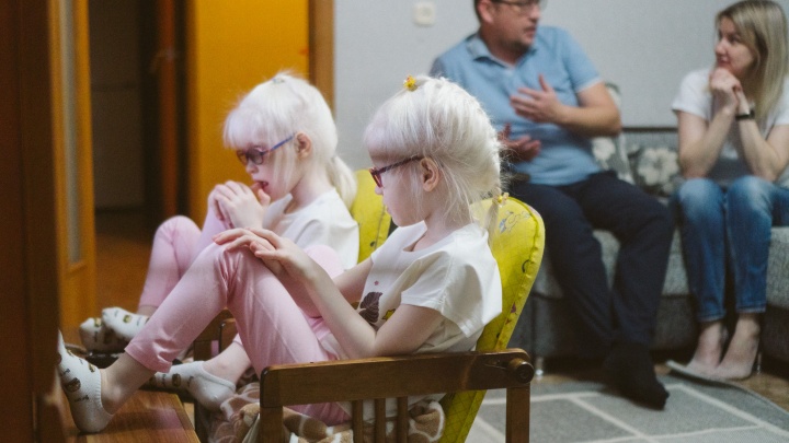 «Каждый считал своим долгом заглянуть в коляску»: история омских двойняшек-альбиносов