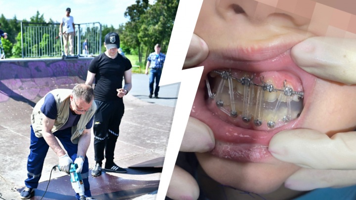 После публикации 76.RU начали ремонтировать опасный скейт-парк, где ребенок сломал челюсть