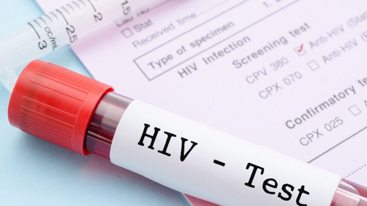 Первые симптомы ВИЧ можно принять за грипп — Центр СПИД посоветовал проверяться раз в год