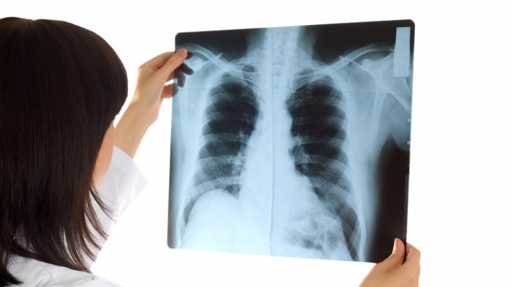 Рентгенографию взрослым и детям от 750 рублей проведут специалисты поликлиники ЧГМА