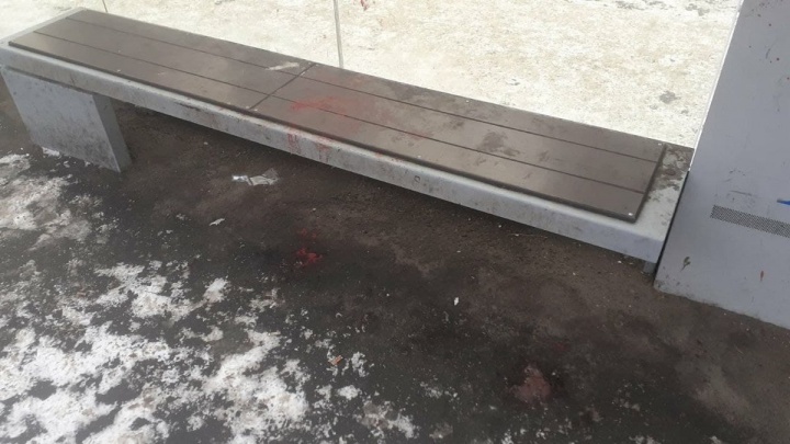 Директор ДМРСУ о крови на скамейке в Чите: Не отмыли — она с первого раза не оттирается