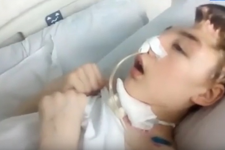 У мальчика серьезная черепно-мозговая травма У мальчика серьезная черепно-мозговая травма
