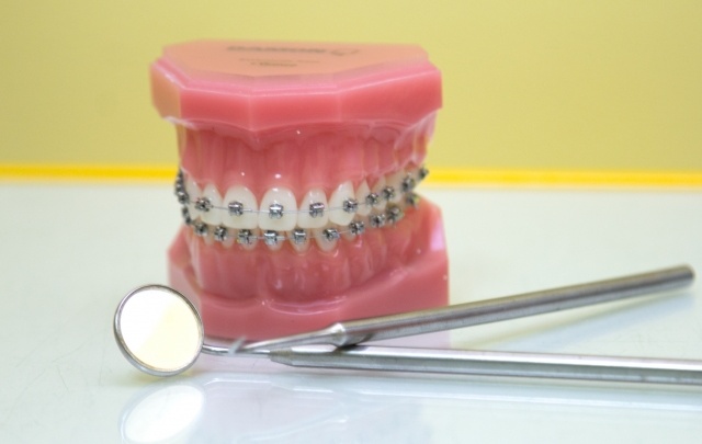 Топ-10 вопросов к стоматологу: о чем чаще всего спрашивают пациенты?