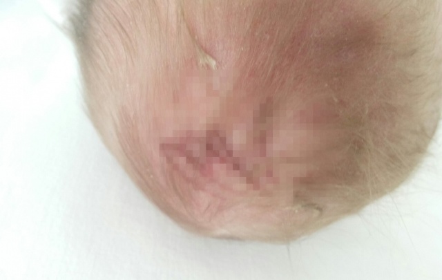 Челябинка после родов обнаружила на голове у ребенка множественные царапины