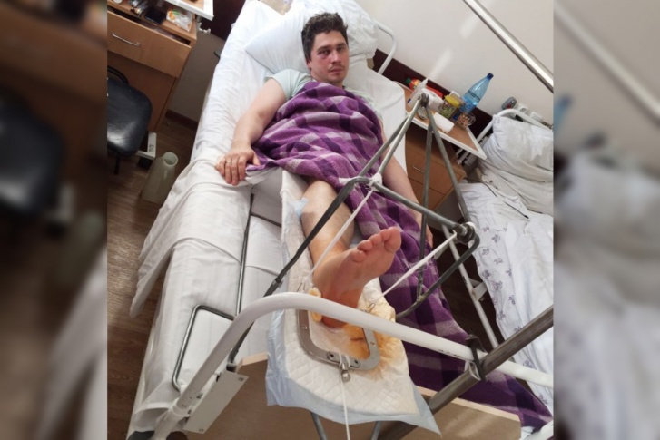 Нападавший прыгнул на лежавшего на земле мужчину, сломав ему ногу Нападавший прыгнул на лежавшего на земле мужчину, сломав ему ногу