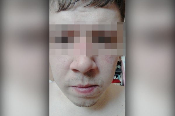 Избитый тюменец рассказал, что его компания изначально пыталась успокоить участников конфликта Избитый тюменец рассказал, что его компания изначально пыталась успокоить участников конфликта