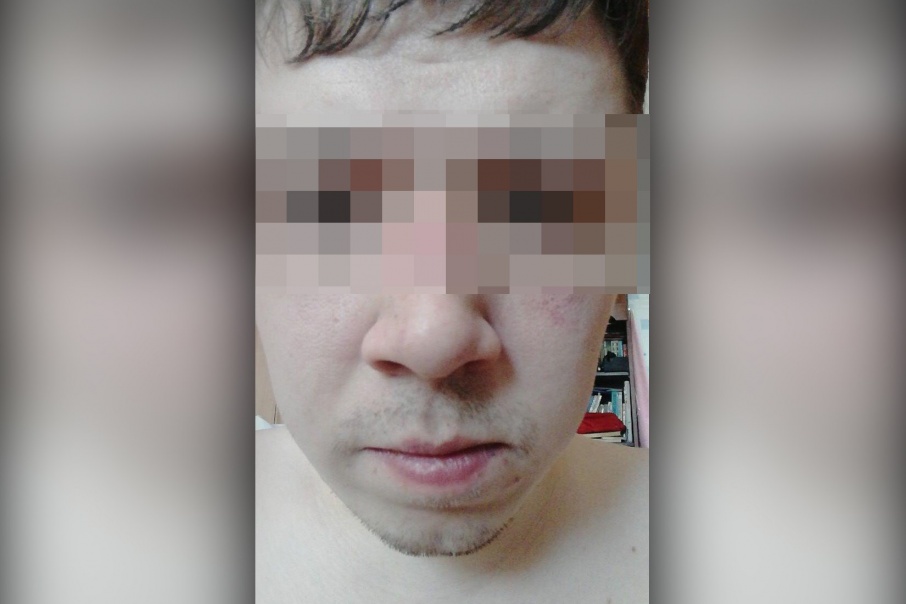 После конфликта Алексей ездил снимать побои После конфликта Алексей ездил снимать побои