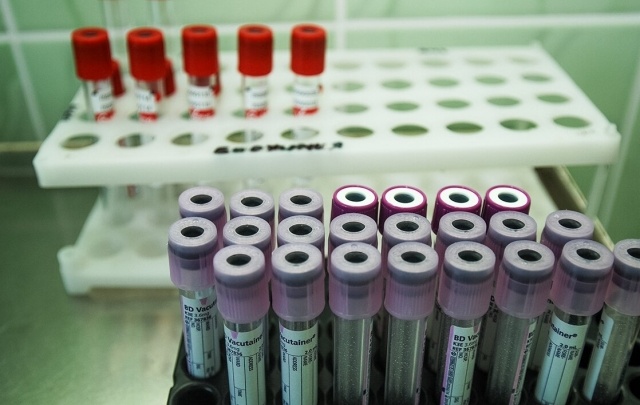 В России тестируют лекарства от рака с индивидуальным подходом