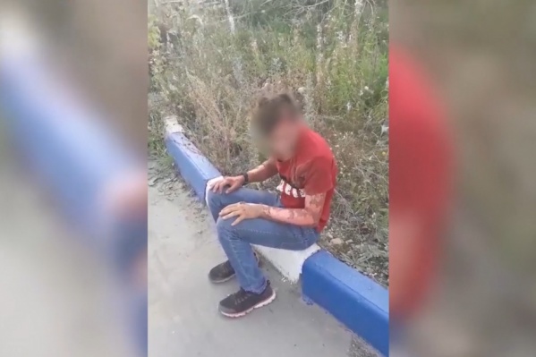 У парня сильно обгорела кожа на руках и лице У парня сильно обгорела кожа на руках и лице