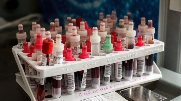 У троих тюменцев выявили ВИЧ во время экспресс-тестирования на Цветном бульваре