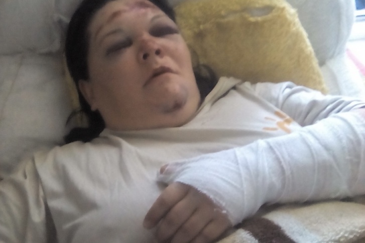 Татьяна попала в больницу с травмами руки и головы
